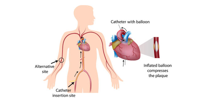 heart-specialist-doctor-in-Gurgaon