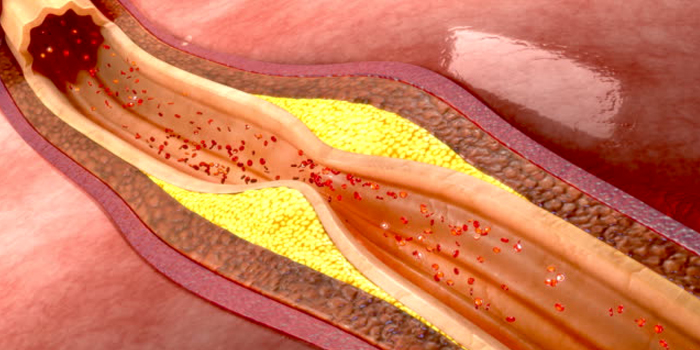 heart-specialist-doctor-in-Gurgaon